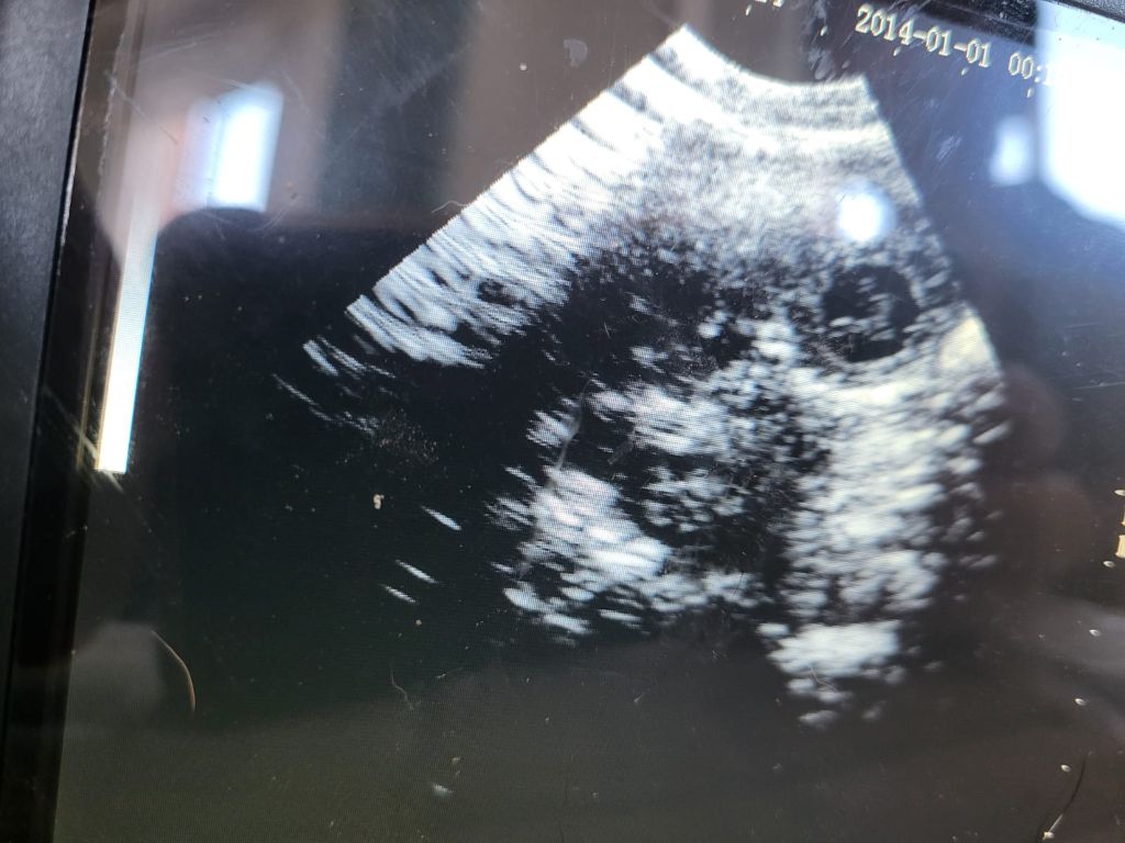 Naissance à venir....
