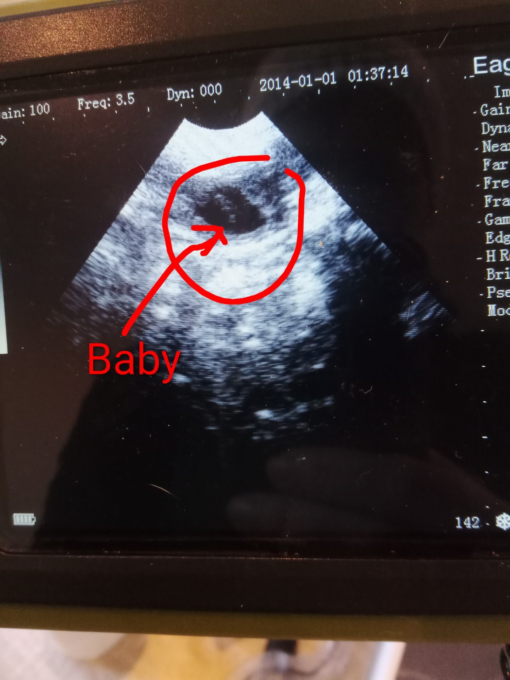 Arrivée prochaine de la portée des 💓 BEAUTIFUL 💓